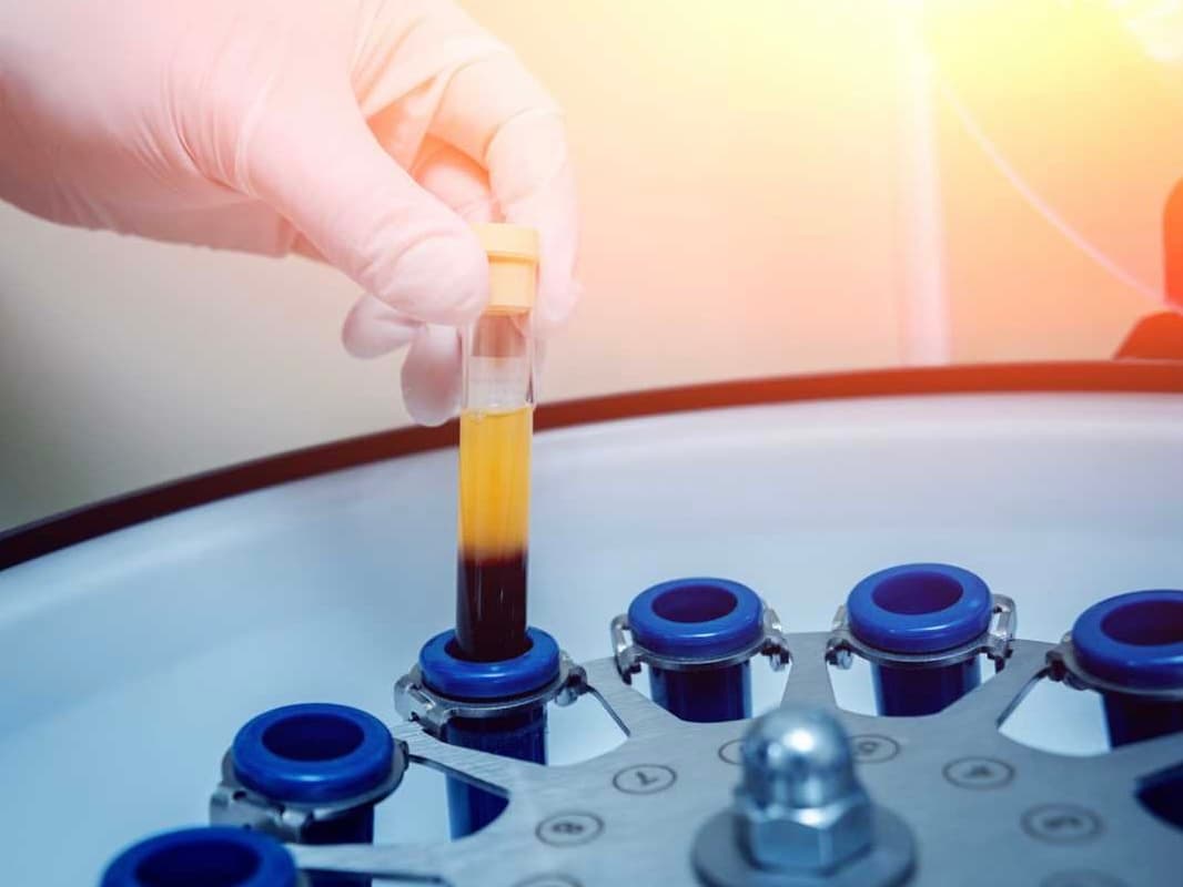 Equipamiento para procesamiento de células madre